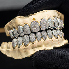 custom grillz